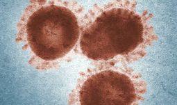 "Banks have a month to prepare before this virus starts starts behaving like an epidemic"